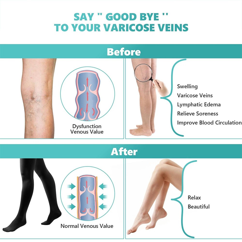 Compression Socks Thigh High Stockings Ladies Women 20-30 mmHg Varicose Veins
