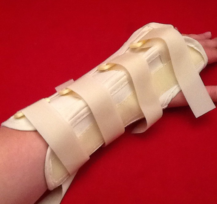 NEW PROCARE 79-87417 HAND WRIST SPLINT LOOP-LOCK 8in LARGE LEFT