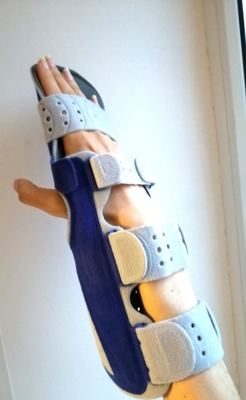 Bauerfeind ManuLoc Long Plus Hand Orthosis Immobilizing Size 3 L-XL