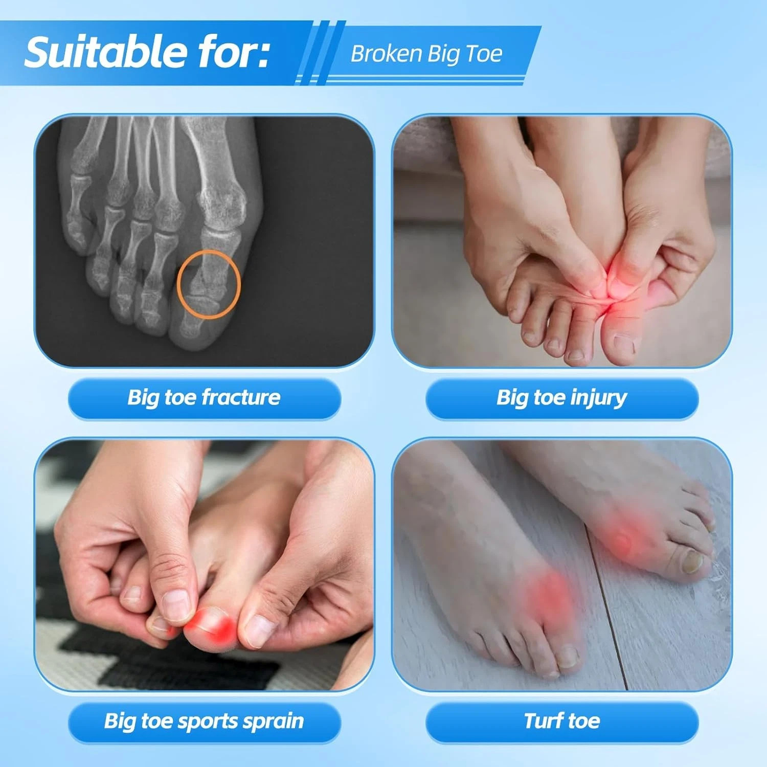 Broken Big Toe Splint Brace, Turf Toe Brace Support for Broken, Fracture, Sprain