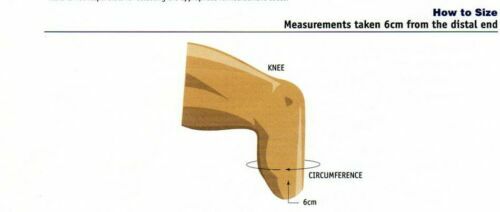 ALPS General Purpose Prosthetic Liner (Cushion/Locking.)