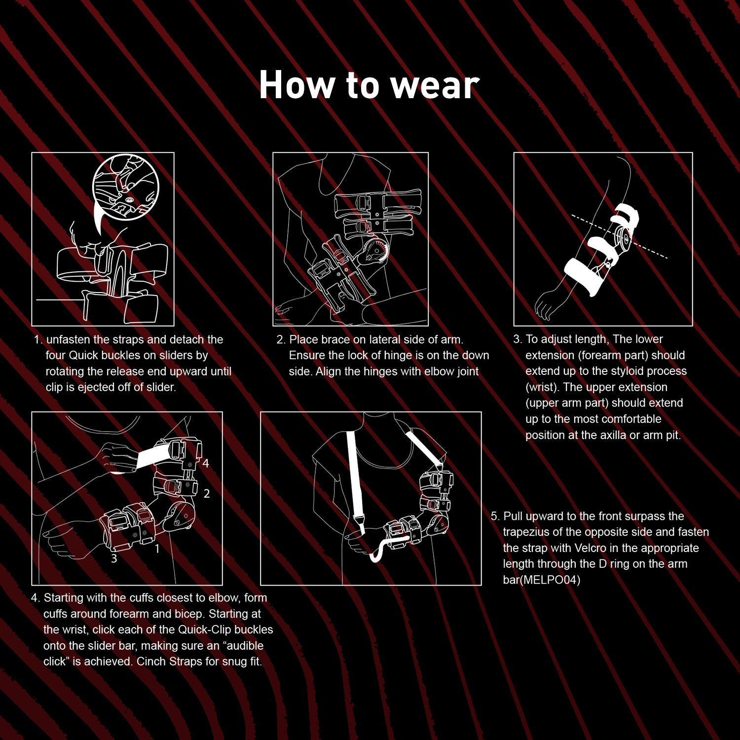 Zoyer Recovery+ Zero Gravity Post-OP Elbow Brace w/ Hand Grip