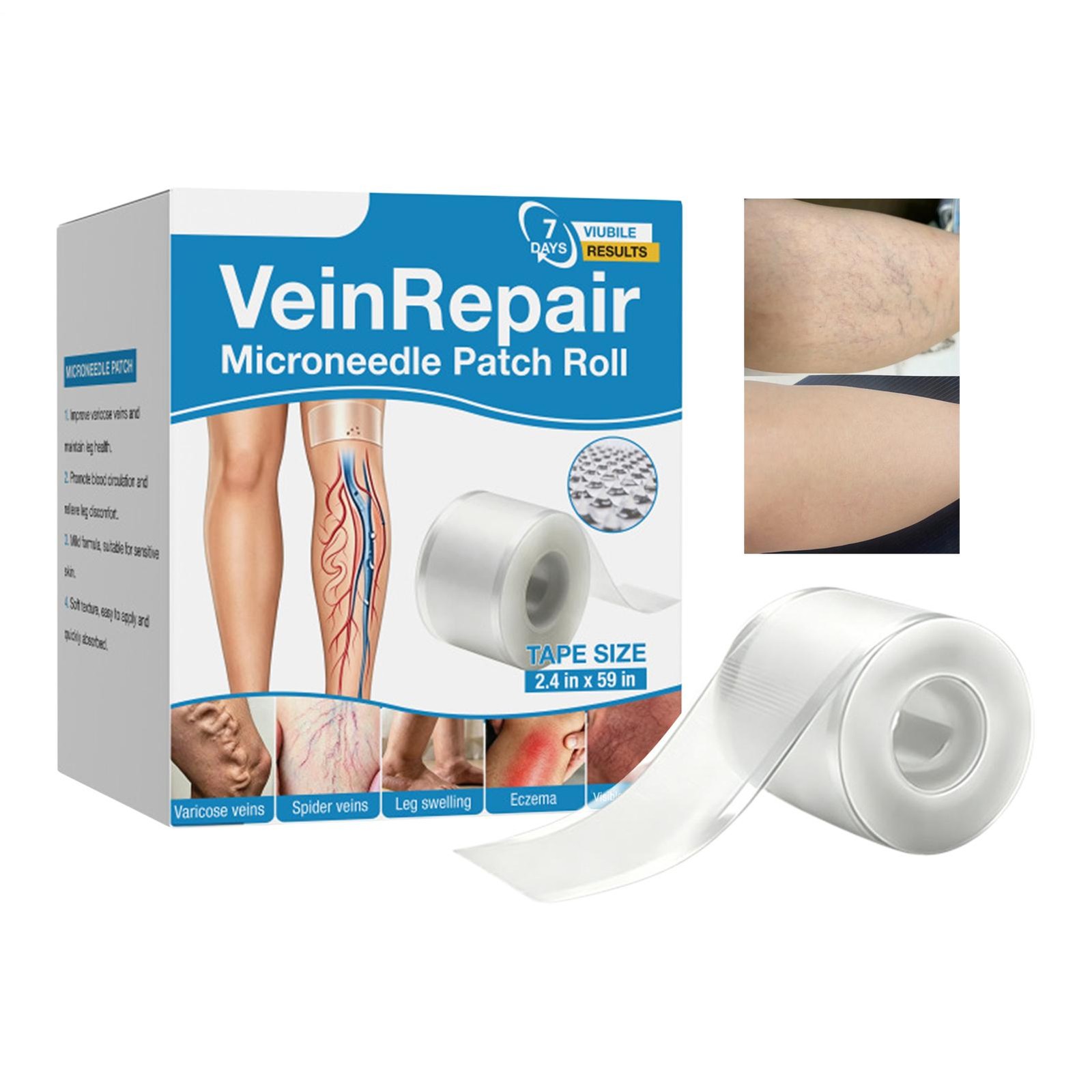 Vein Repair Microneedle Patch Roll, Vein Repair Patches, Professional Treatment