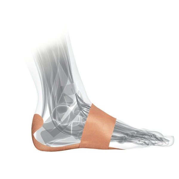 Mueller PFTape System For Plantar Fasciitis: Plantar Fasciitis / 7/pack (Tan)