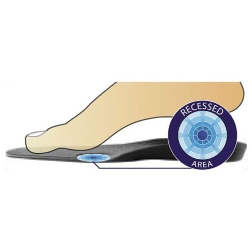 DonJoy. Arch Rival Black Size B Orthotic Inserts Pair for Subtle Cavus Foot