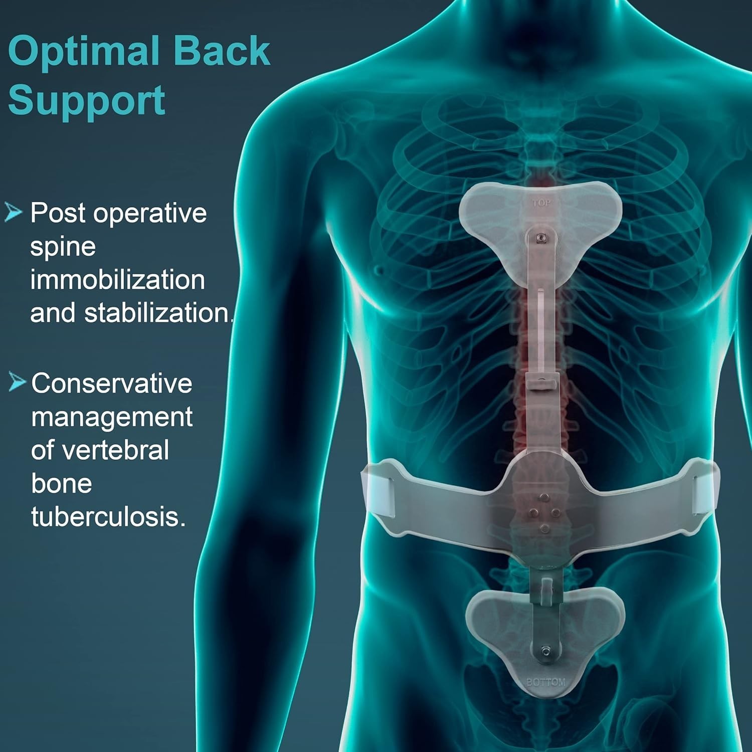 Tynor Aluminium Hyper Extension Brace Ash Brace Healthcare Rehabitalization