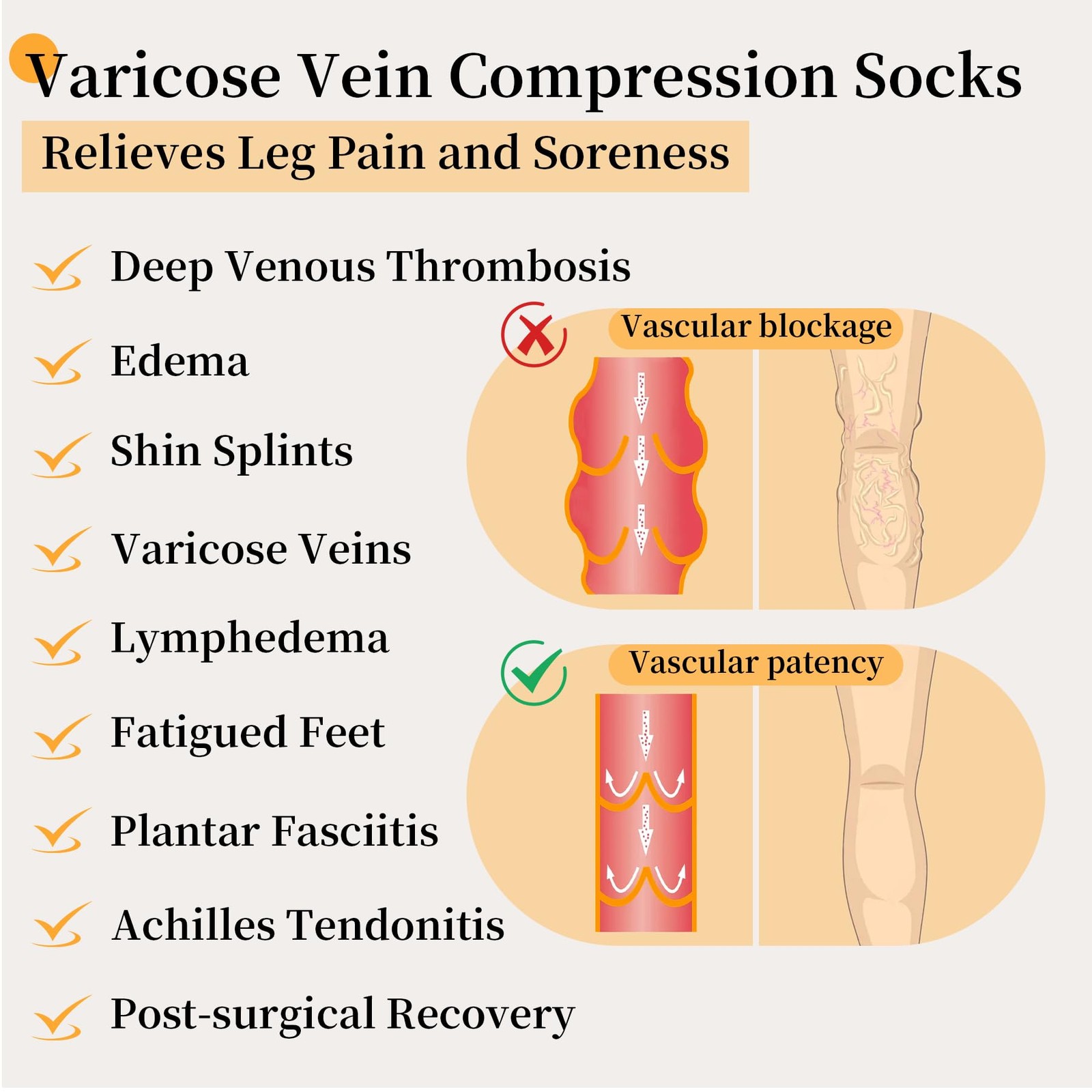 20-30mmhg Thigh High Compression Socks, Compression Stocking