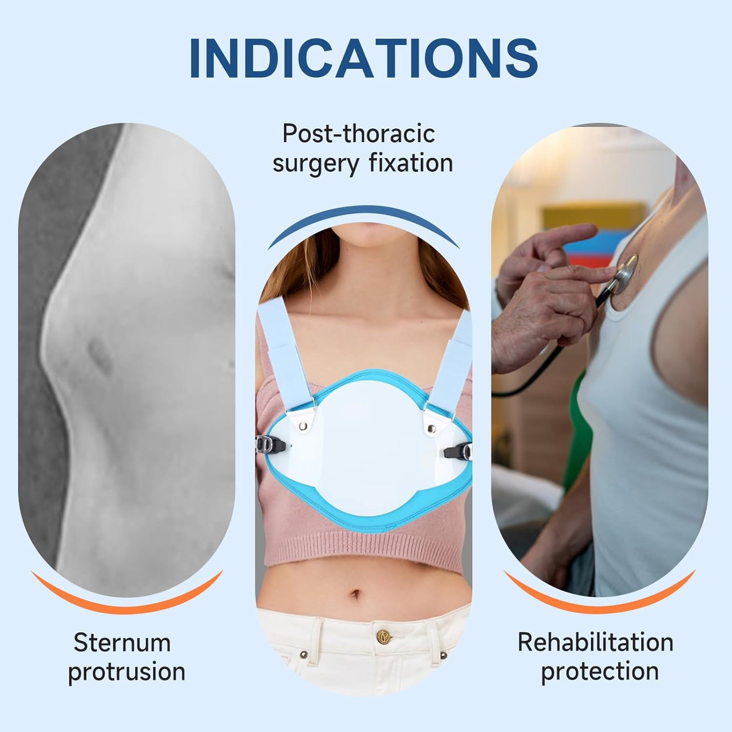 Pectus Carinatum Orthosis Brace, Adjustable Pigeon Chest Orthosis Support, Ribs