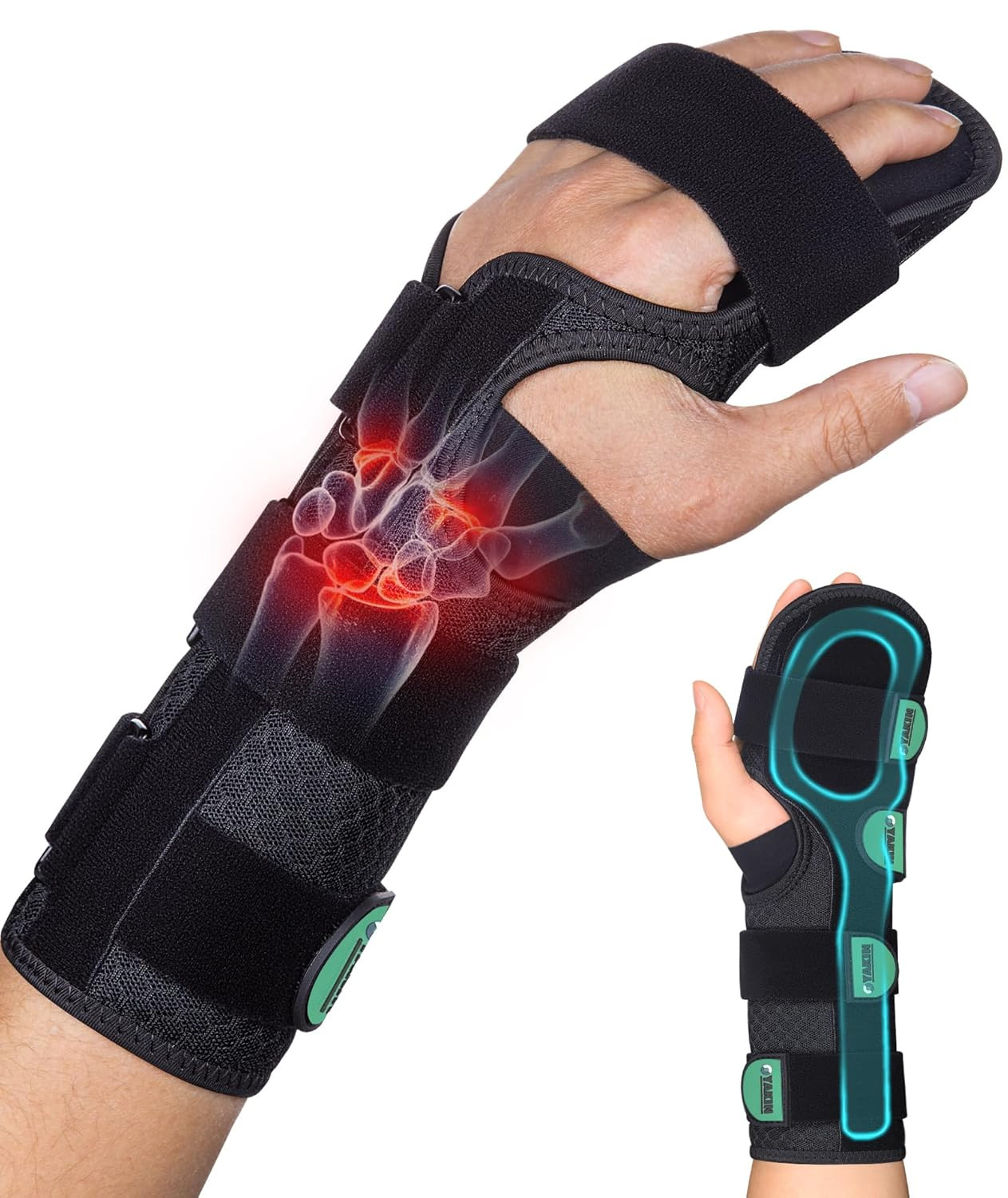 Resting Hand Splint for Stroke Recovery & Carpal Tunnel Relief – Night Immobi…