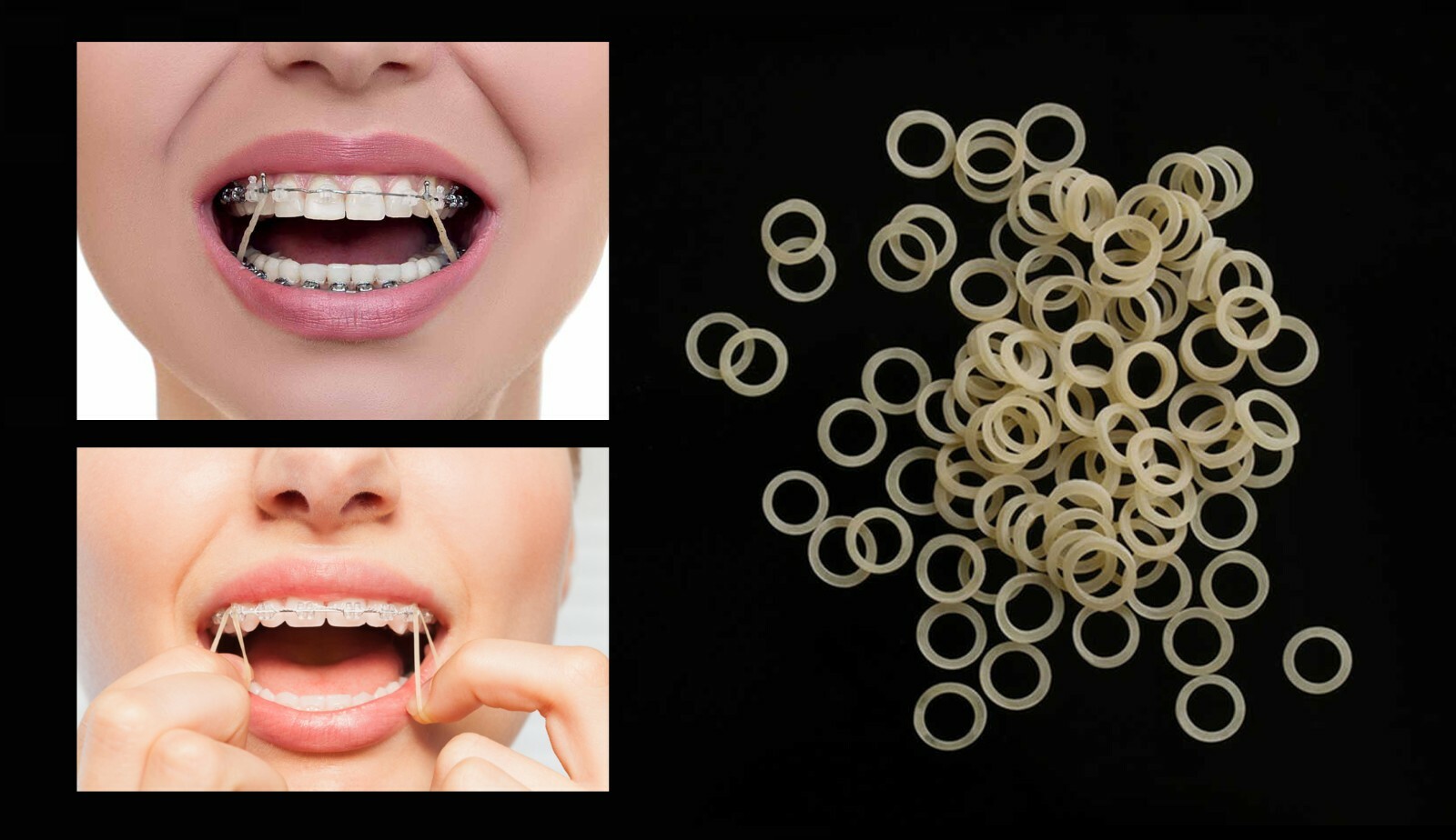 100pcs Dental Orthodontic Braces Latex Elastic / Rubber Band (various sizes)