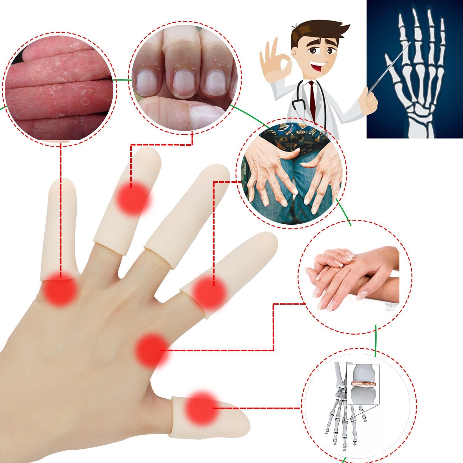 Gel Finger Cots, Finger Protector Support14 PCS NEW MATERIAL Finger Sleeves G…