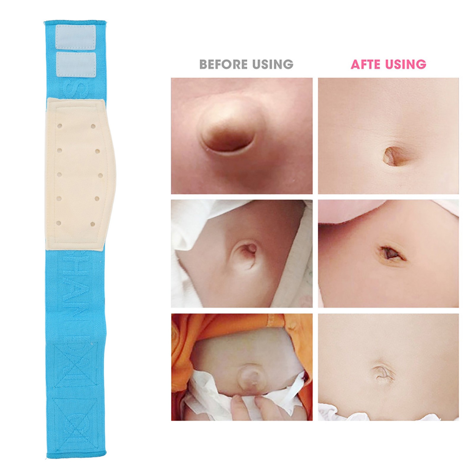 Baby Umbilical Hernia Belt Cozy Cotton Fabric For Tummy Pain Relief 0-12 Months