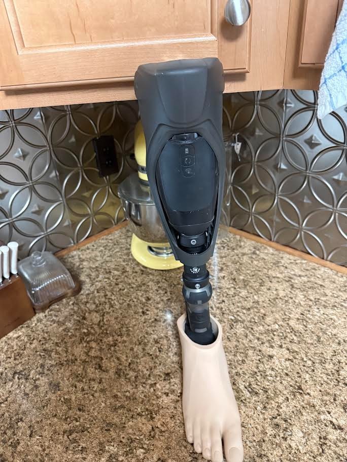 Prosthetic Leg Above Knee ( Cosmetic Damage ) Proteor Quattro MicroProcessor