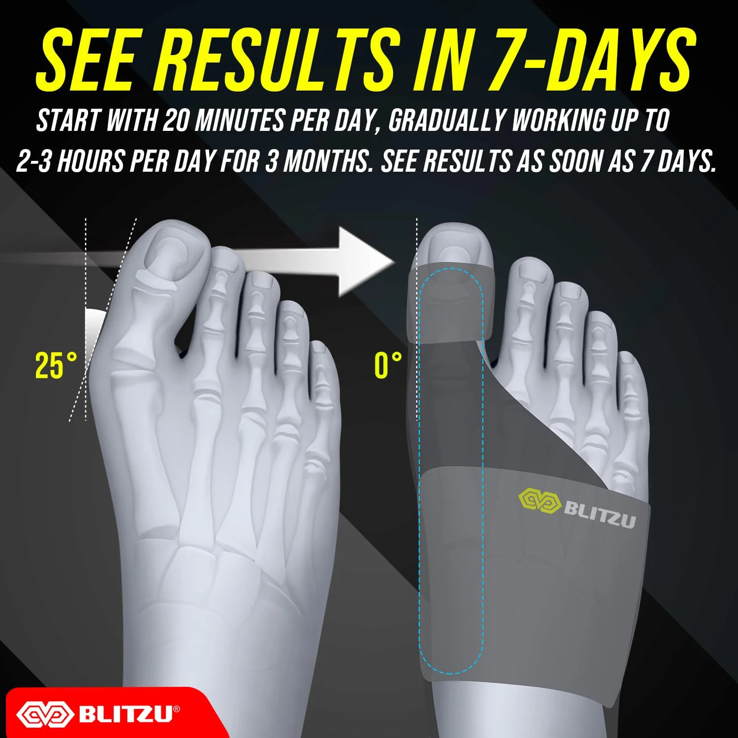 2 Pack Adjustable Bunion Corrector for Women & Men, Orthopedic Bunion Splint for