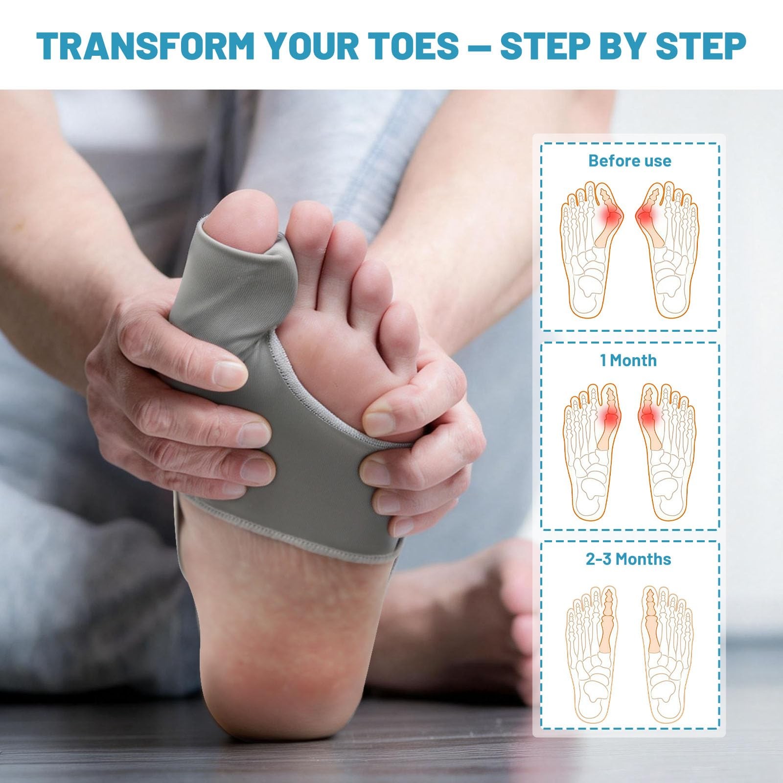 Swpcioc Bunion Corrector Gray 1pc