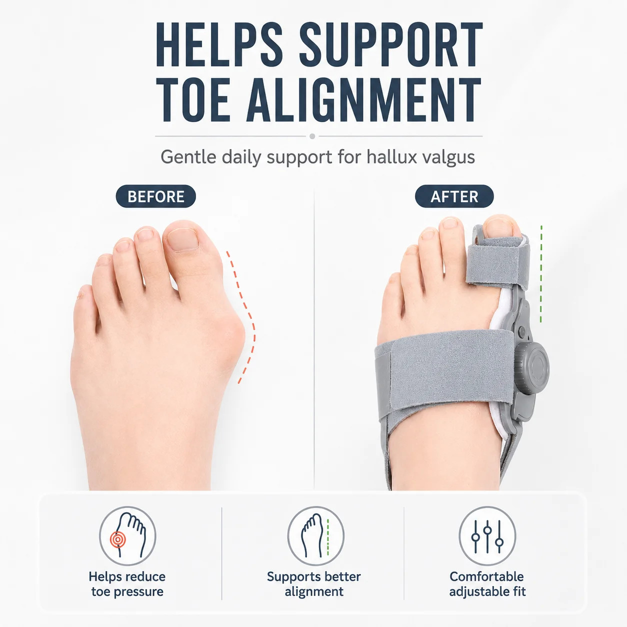Adjustable Hallux Valgus Corrector Big Toe Straighten Bunion Support Brace Foot