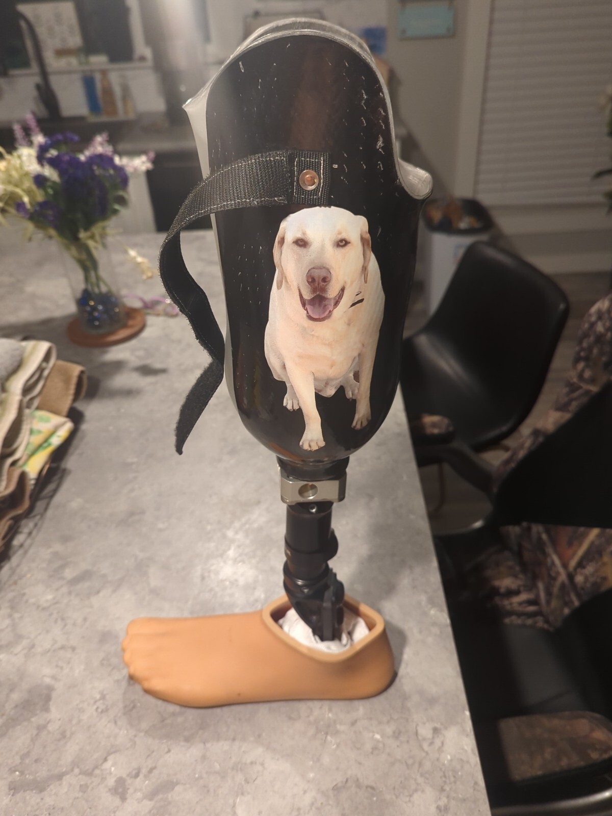 prosthetic leg
