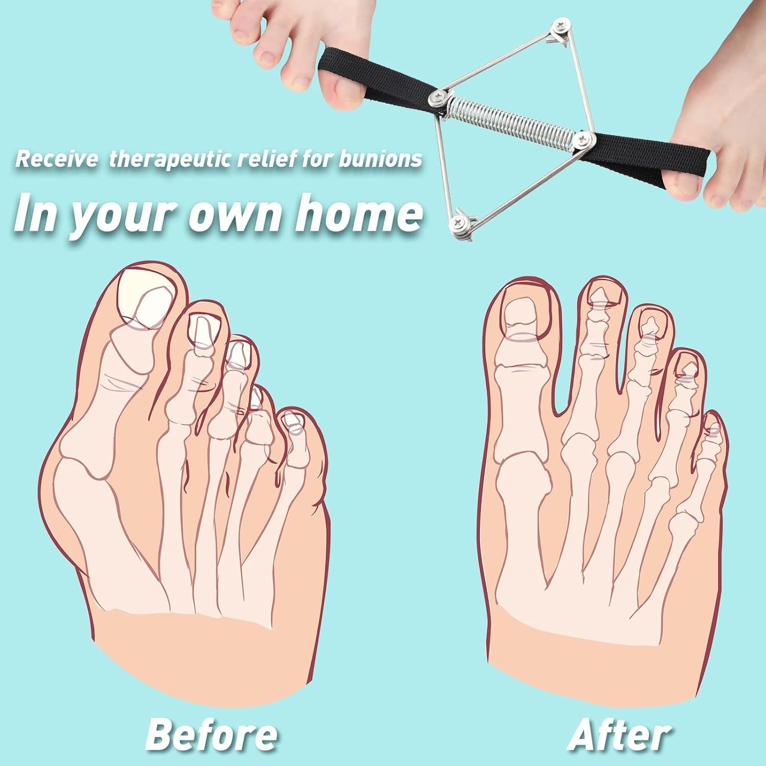 Pilates Method Bunion Corrector Toe Straightener Exerciser Foot Pain Relief