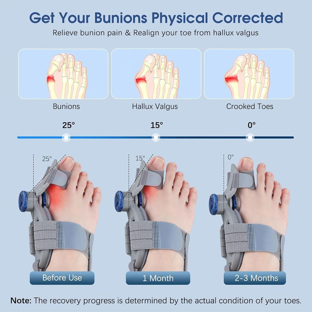 1Pair Bunion Fix Toe Valgus Corrector Big Toe Straightener for Men & Women, US