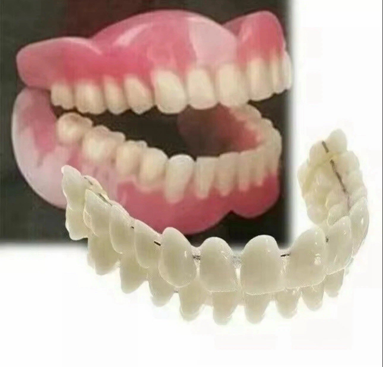 Self-Fit Boil & Bite Denture for Narrow or Wide Arches – Confidence at Home