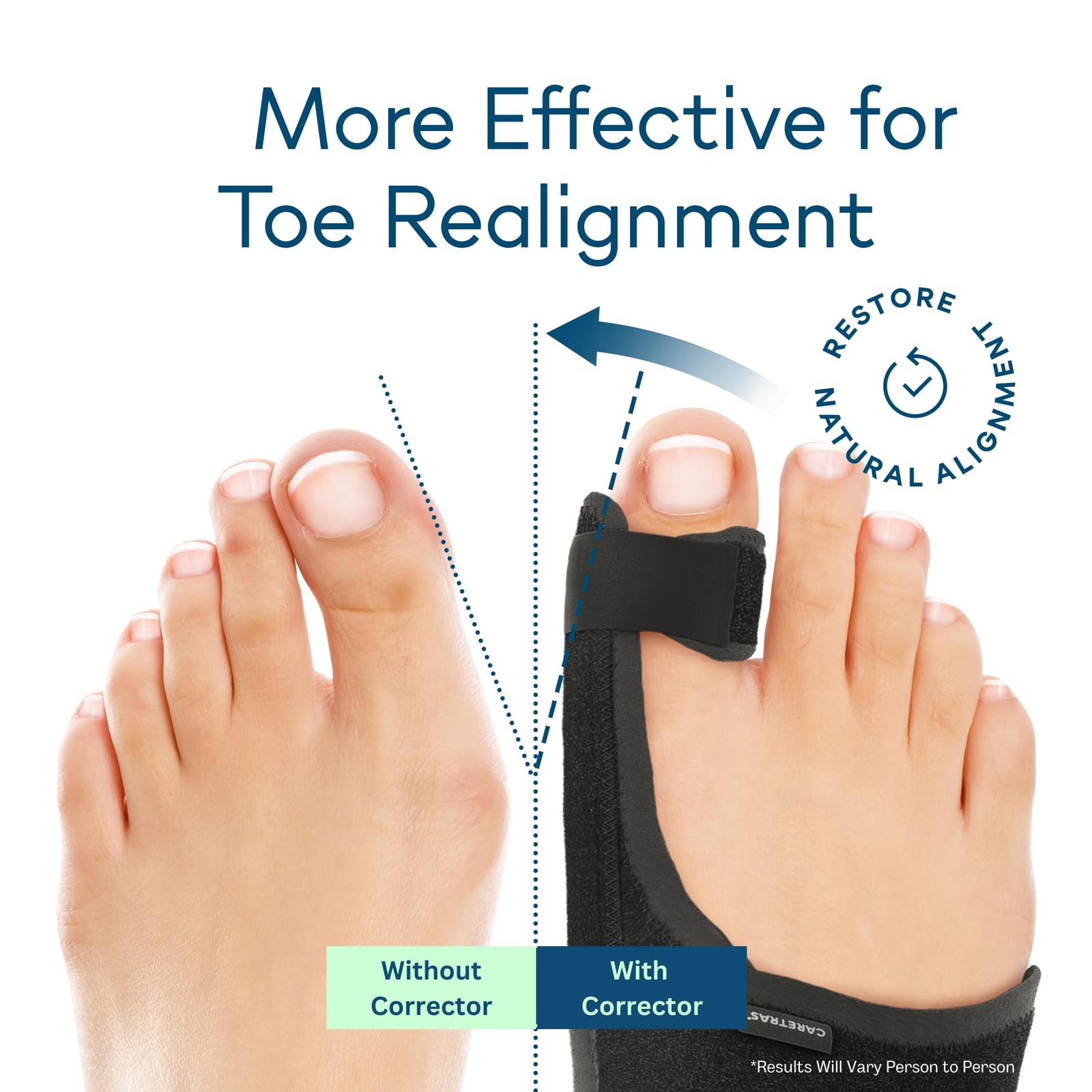 Caretras 2-Pack Bunion Corrector for Women & Men, 2 Count (Pack of 1), Black