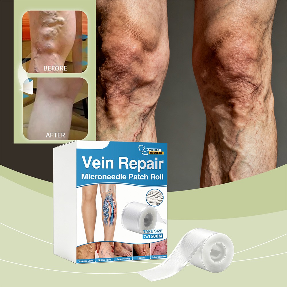 7cm*150cm Vein Repair Microneedle Patch Roll, Professional Vein Repair Patches
