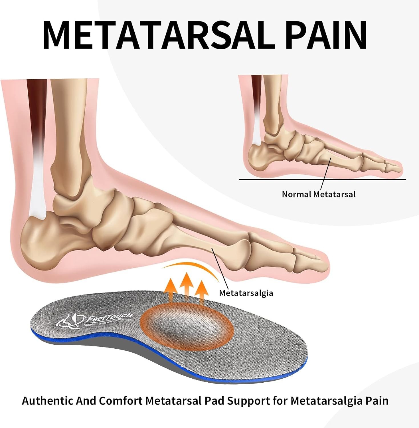 Strong Arch Support Orthotics for Metatarsalgia Mortons Neuroma,Ball of Foot…