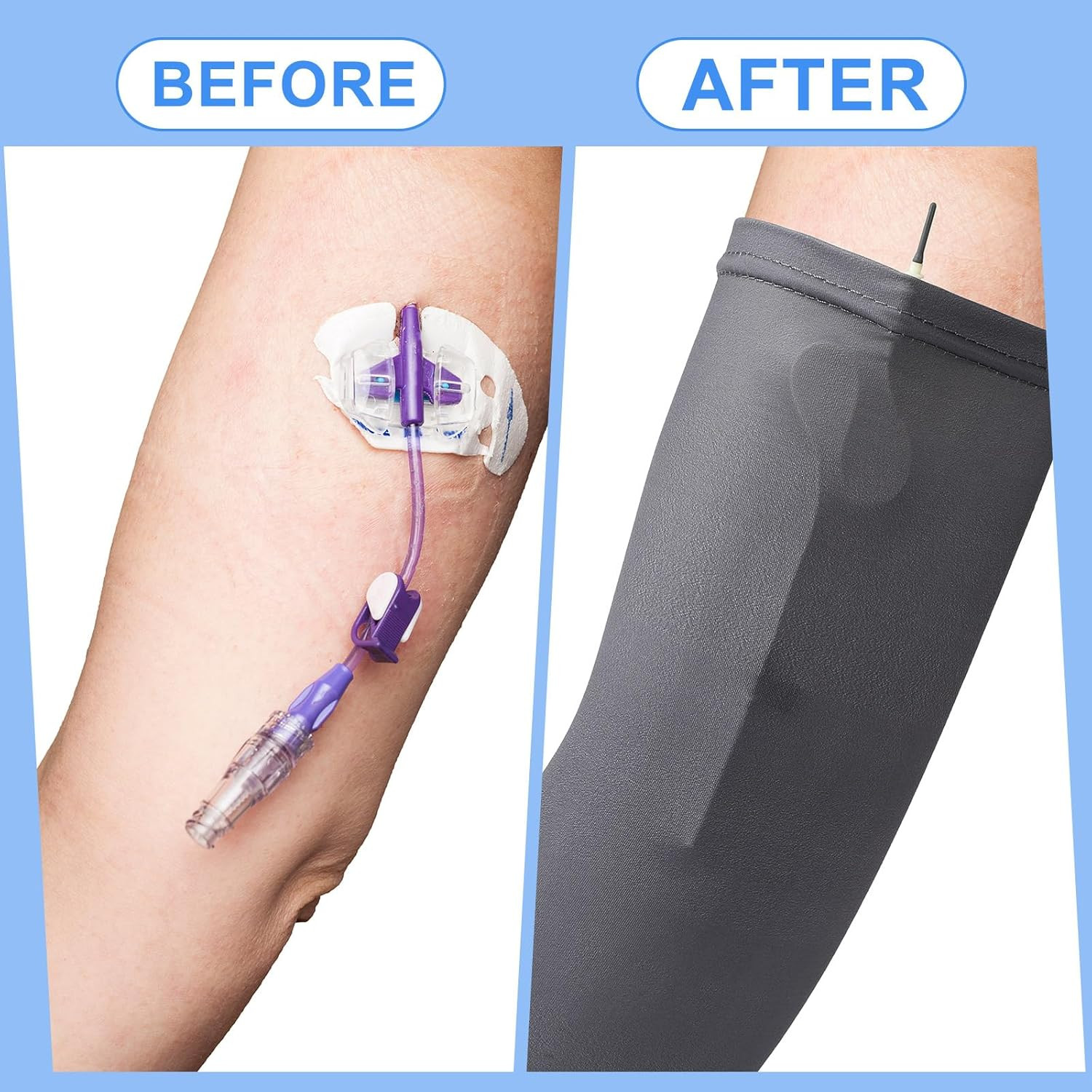 12 Pcs PICC Line Reusable Sleeve Cover for Adults Upper Arm Breathable Cover Nur