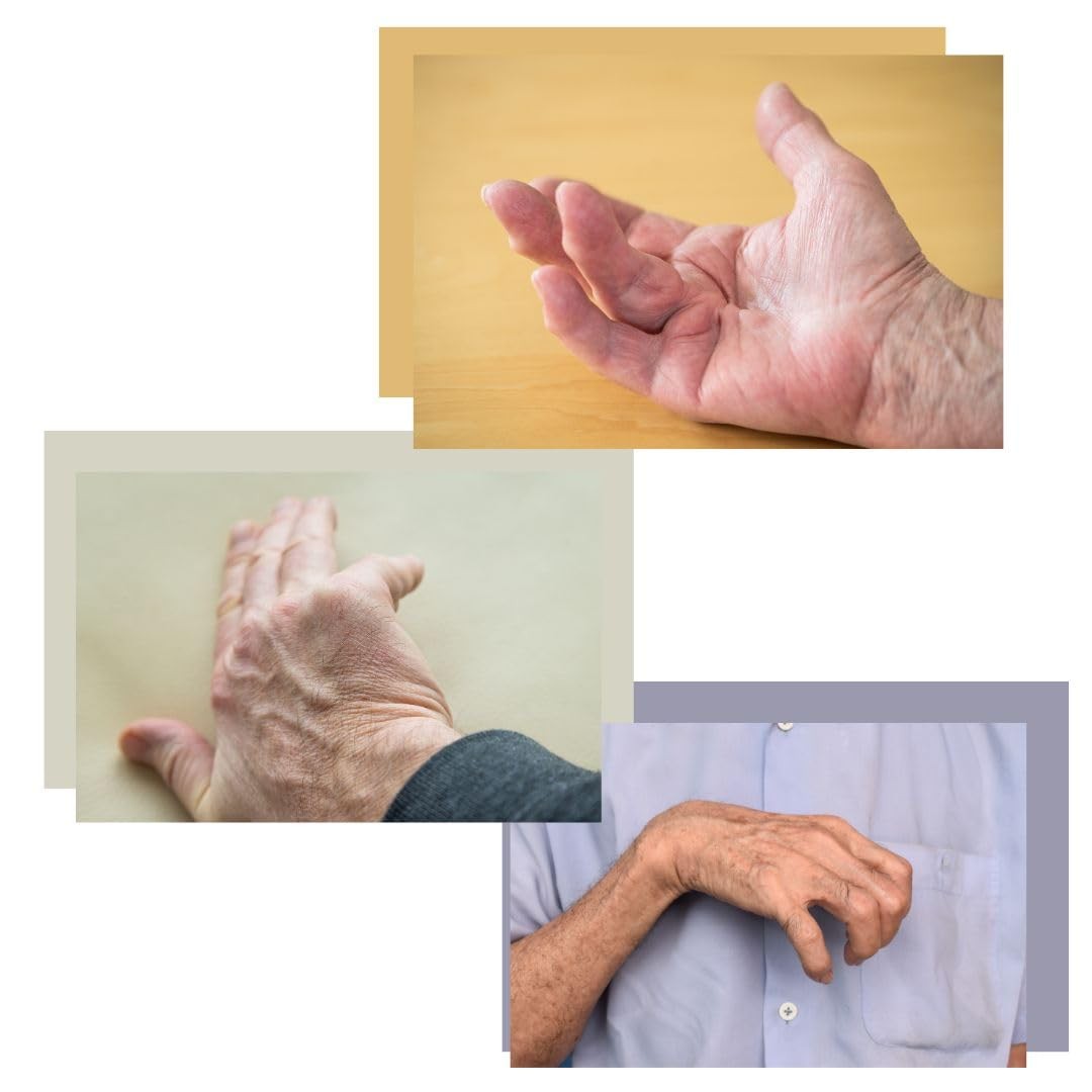 BendEase Hand Splint – Wrist Pain for Carpal Tunnel, Arthritis and Stroke Rec…