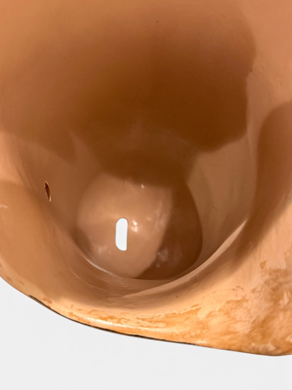 Right above the knee prosthetic socket. Not for medical use.