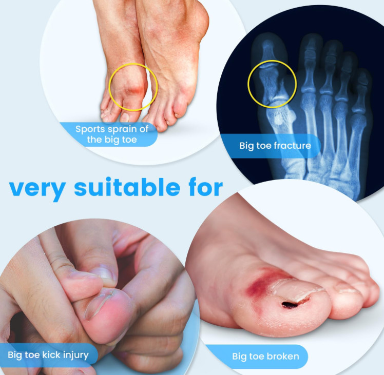 Big Toe Splint for Women & Men, Broken Big Toe Support Brace for Fracture LEFT