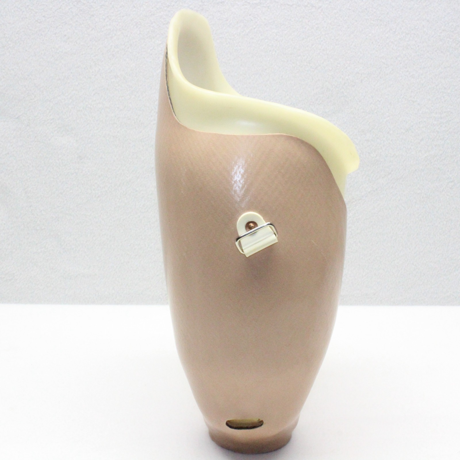 ABOVE KNEE PROSTHETIC LEFT LEG SOCKET SYSTEM w/ KISS DISTAL ~W=5.5×6″ H=9.5×14″