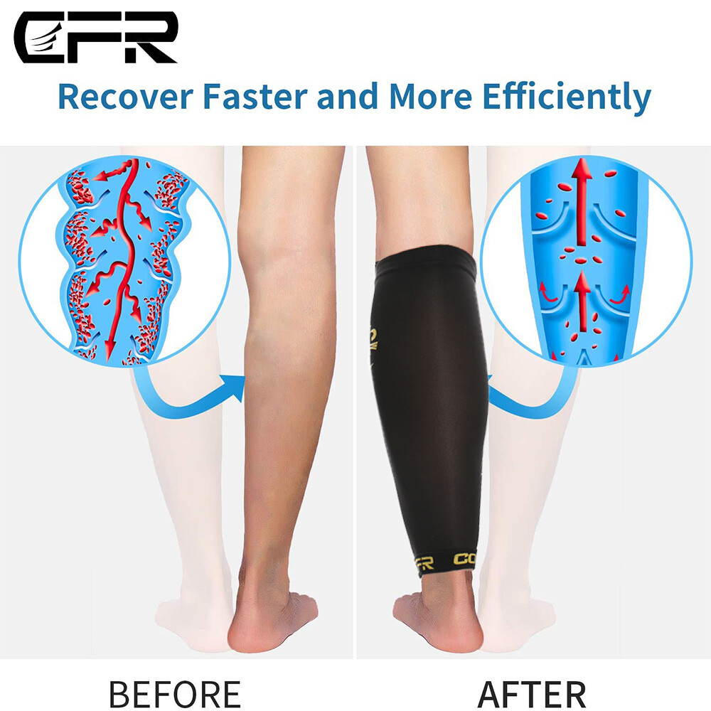 Copper Compression Socks 20-30mmHg Support Calf Leg Sport for Men Women Workout