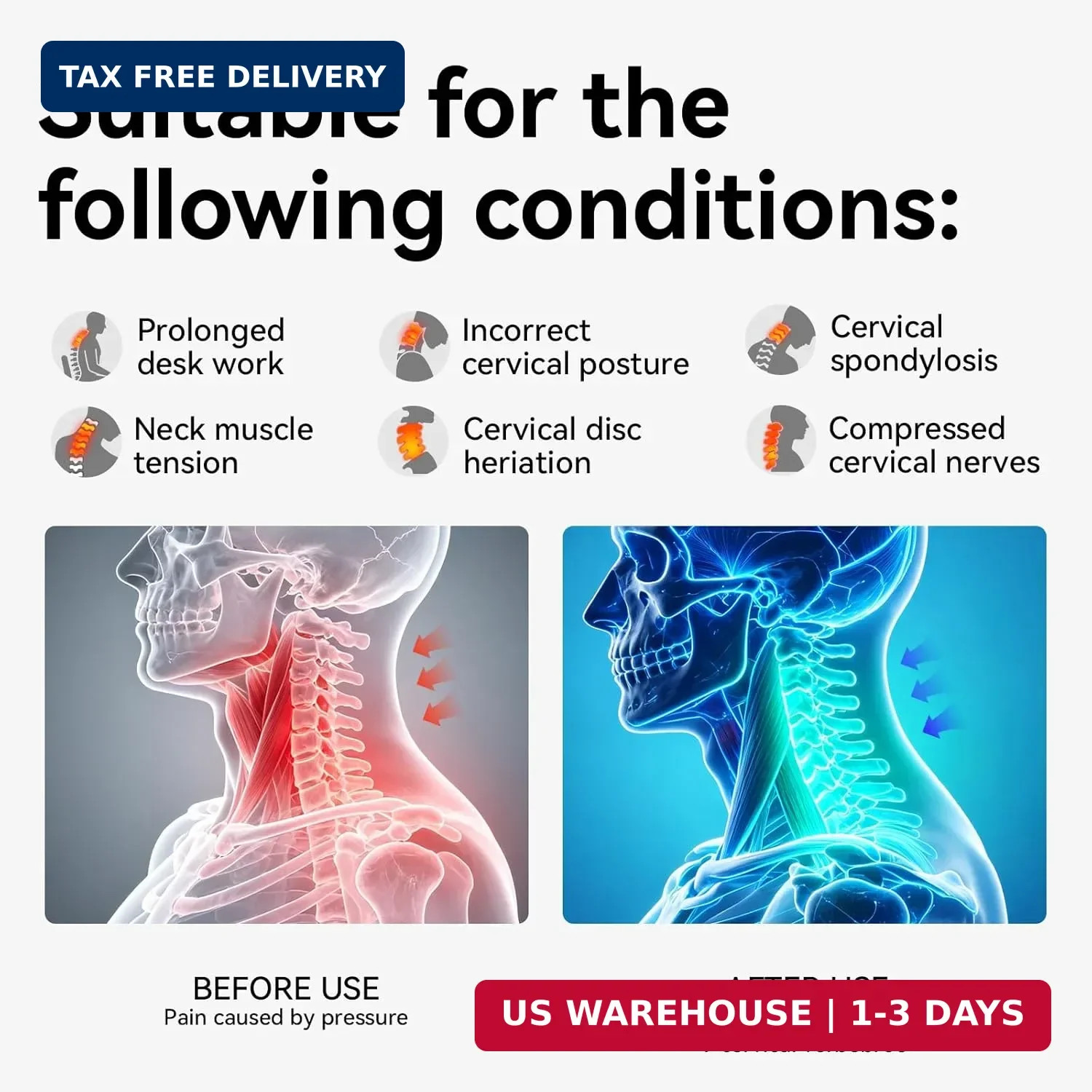 Posture Corrector for Neck & Cervical Spine Alignment – 360° Adjustable Neck Col