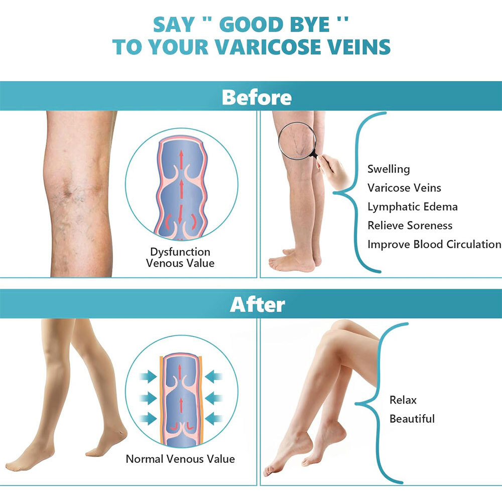 20-30 mmHg Medical Compression Pantyhose Support Hose Varicose Veins Stockings