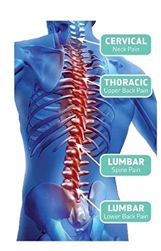 Posture Corrector for Men & Women | Adjustable Upper Back Brace | Provides Ne…