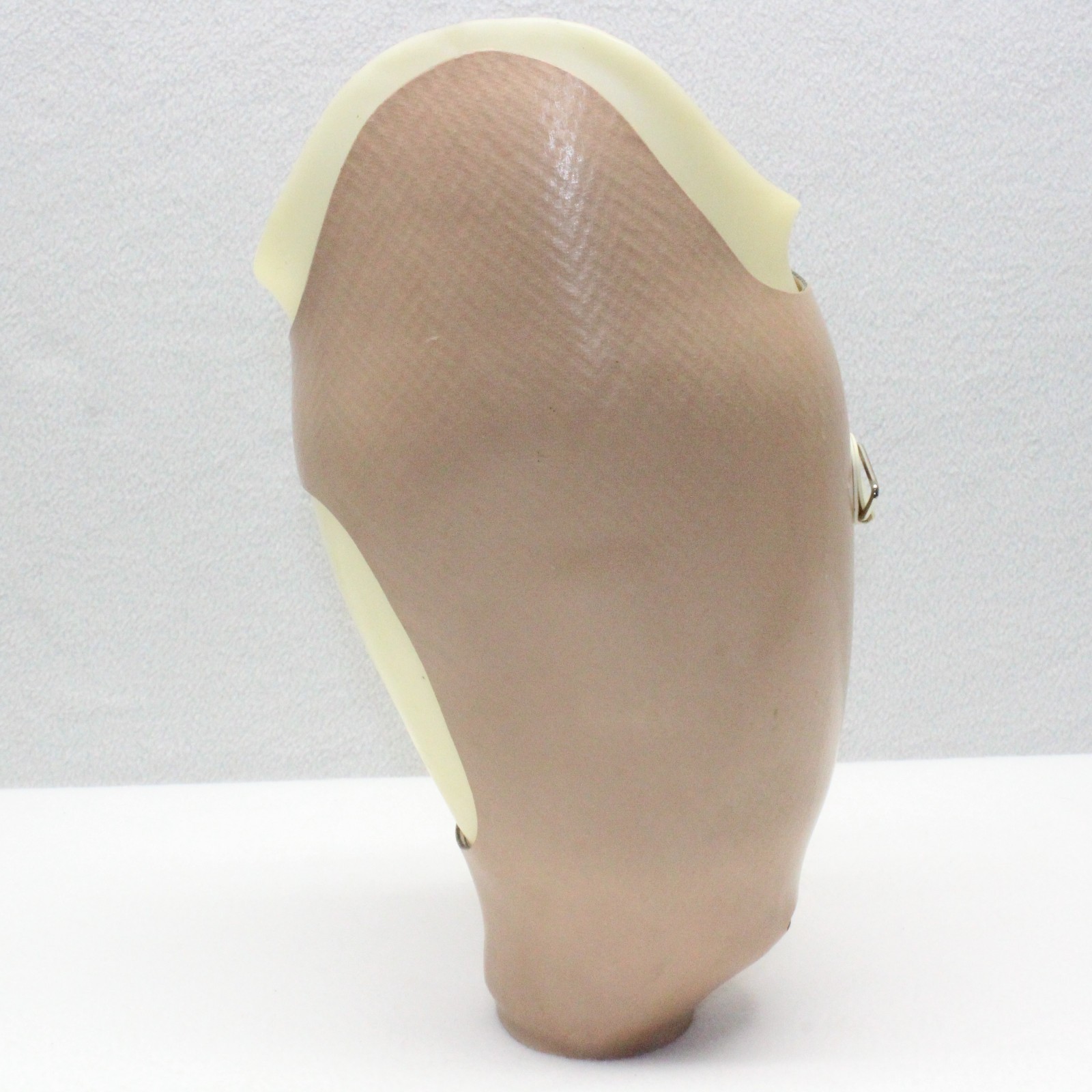 ABOVE KNEE PROSTHETIC LEFT LEG SOCKET SYSTEM w/ KISS DISTAL ~W=5.5×6″ H=9.5×14″