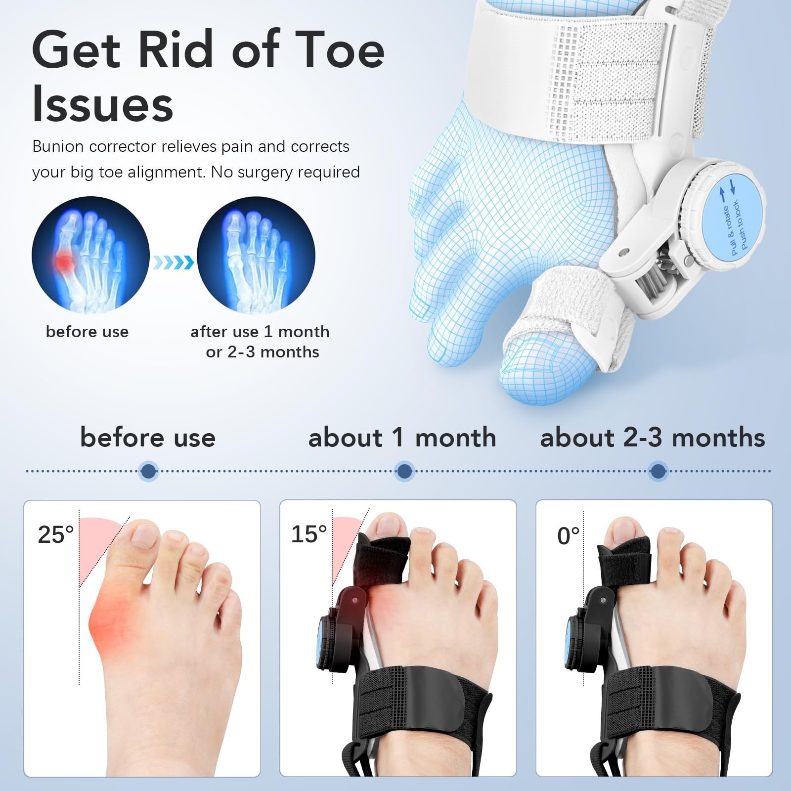 Bunion Fix Toe Valgus Corrector Big Toe Straightener Adjustable for Men & Women