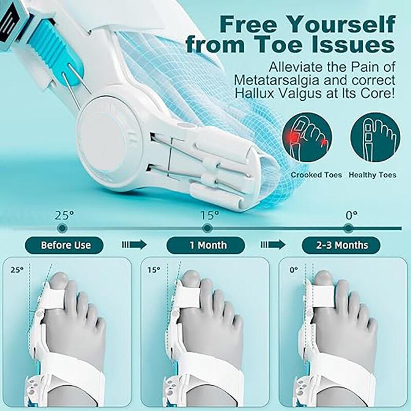 Bunion Corrector Hallux Valgus Big Toe Straightener Splint Separator Pain Relief