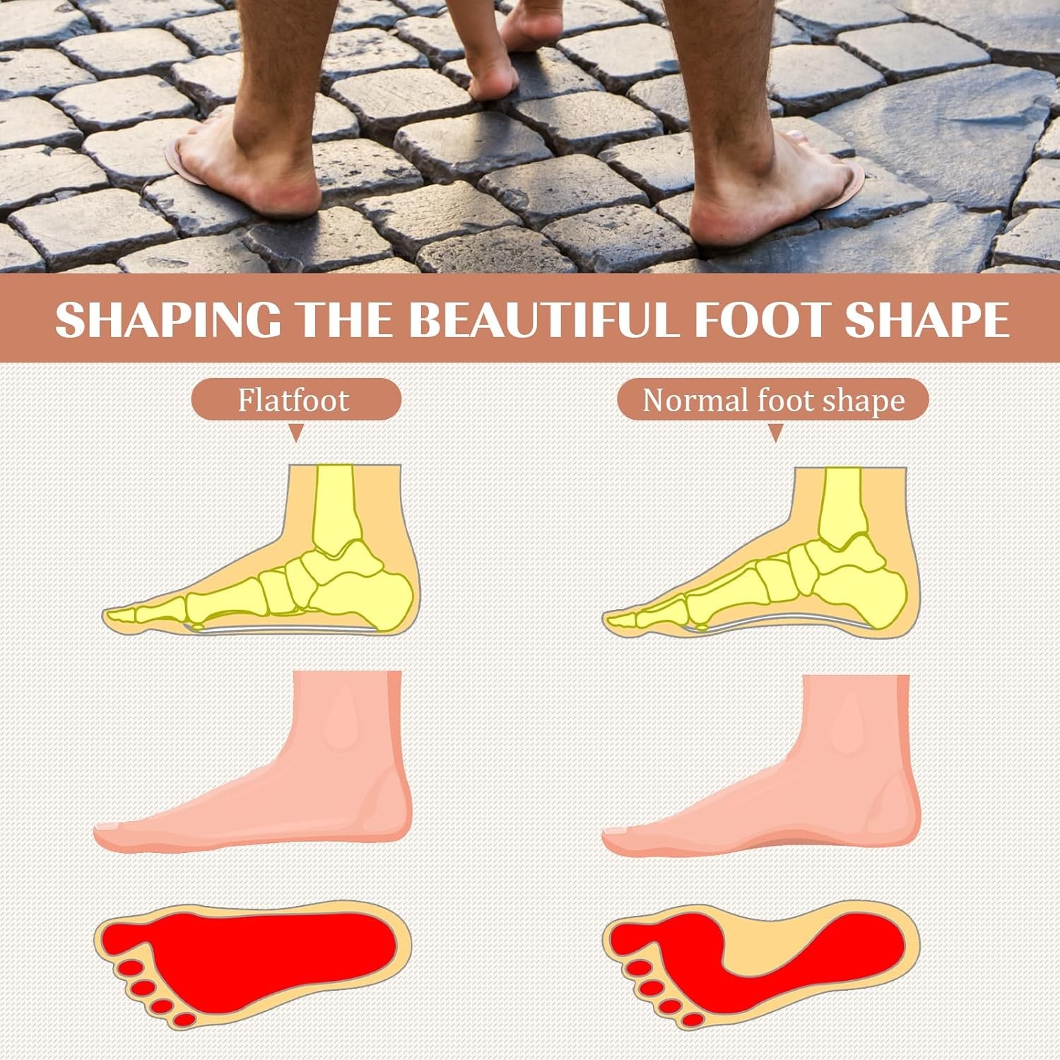 BBTO 2-Pack Toe Hammer Corrector Splint Metatarsal Support