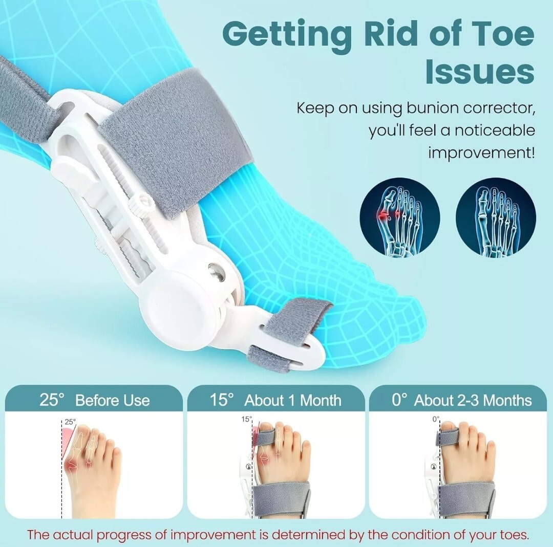 bunion aid splint