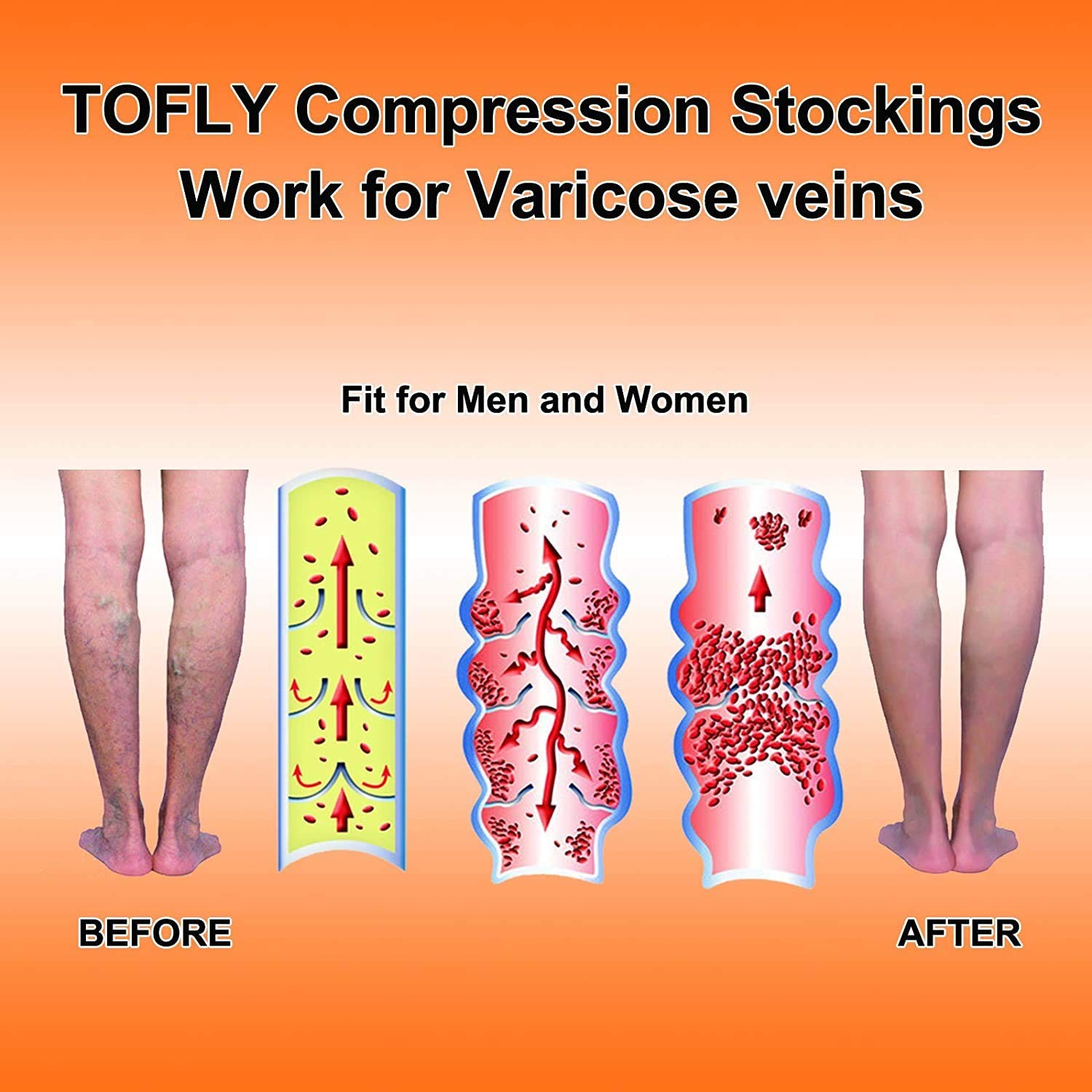 ® Calf Compression Sleeve for Men & Women, 1 Pair, Footless Compression Socks…