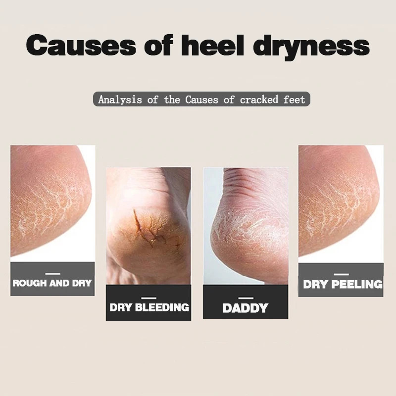 Breathable Heel Protectors – Anti-Crack Moisturizing Socks,Crack Moisturizing So