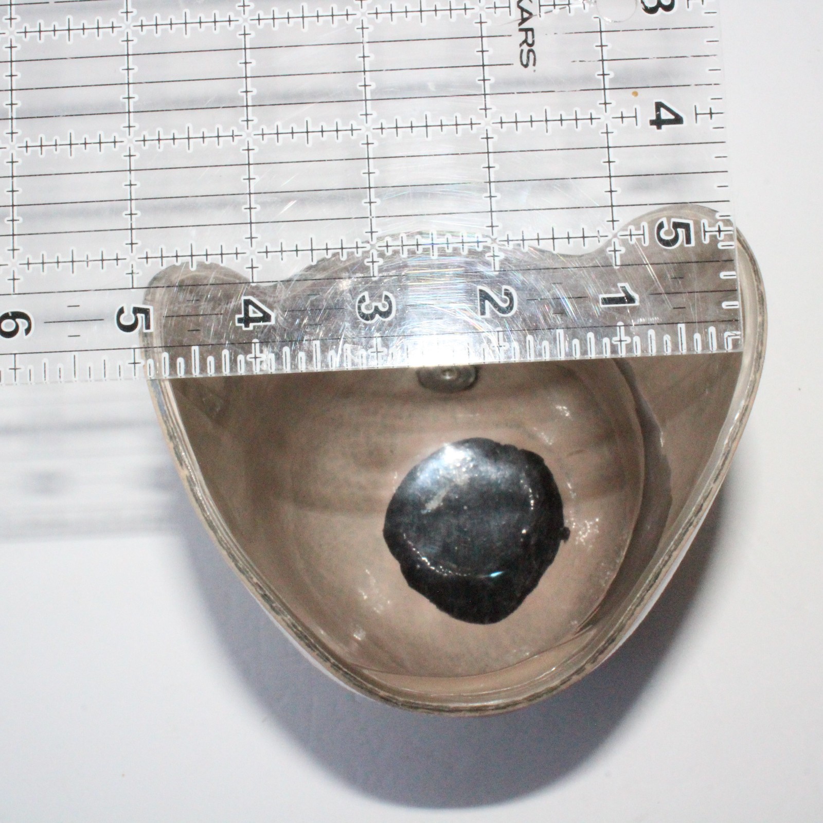BELOW-KNEE PROSTHETIC SOCKET w/ EVOLUTION VMP-001 DISTAL BASE + VACUUM VALVE