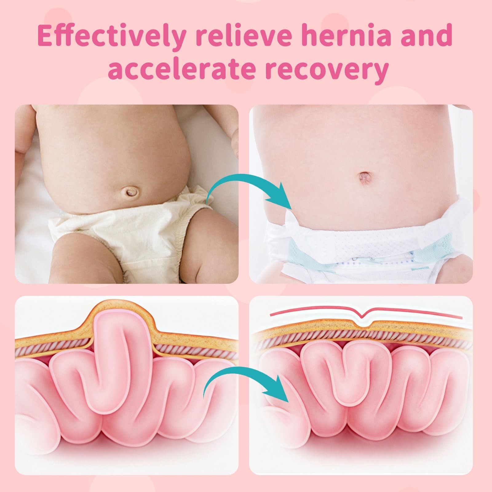 Baby Umbilical Hernia Belt Navel Band 3 Compression Pads 14-21 Inch Pink