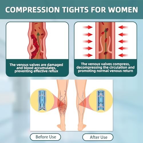 20-30mmHg Compression Pantyhose for Women – Medical Support Stockings, Footless