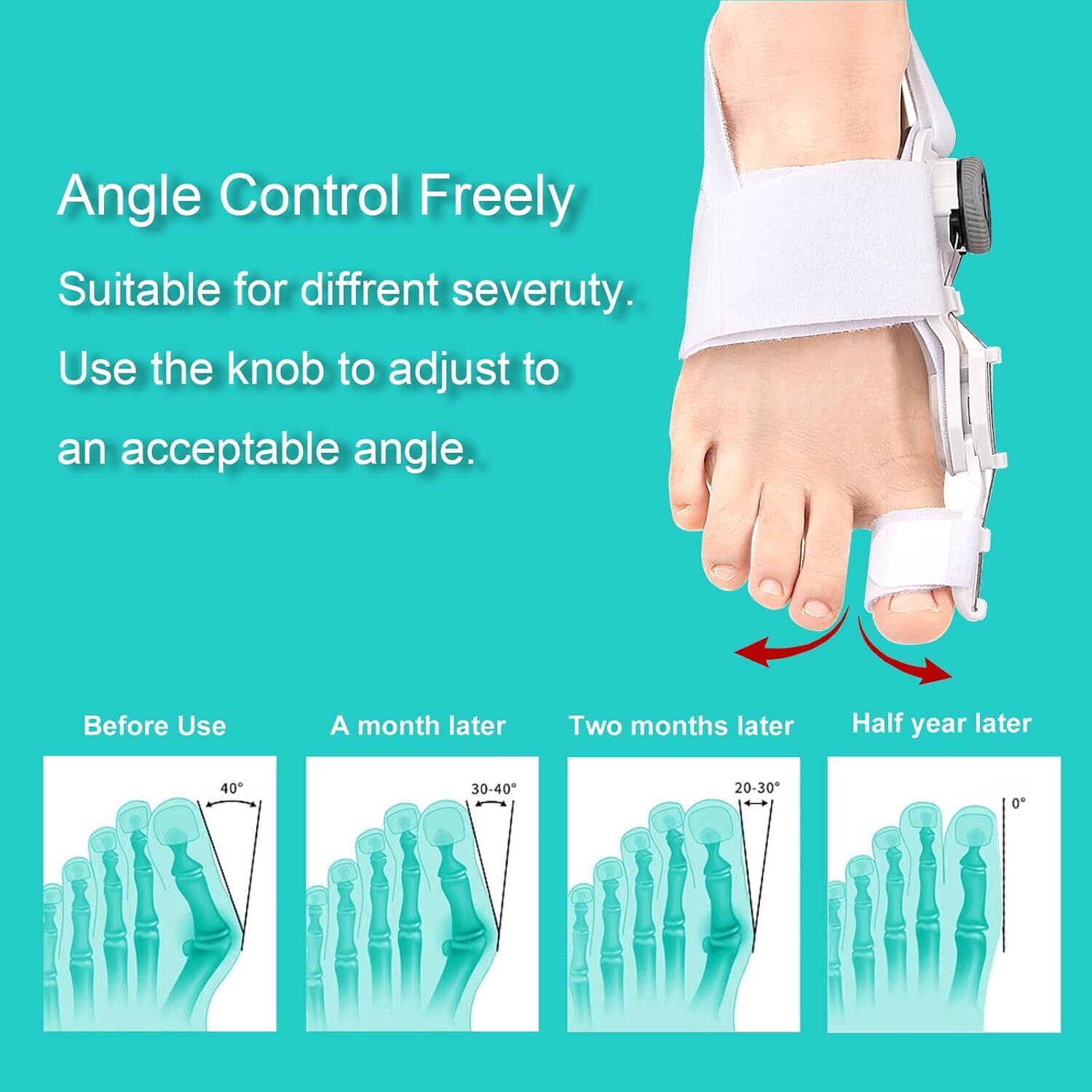 Hallux Valgus Pain Support Big Toe Orthopedic Bunion Straightener Corrector Pro