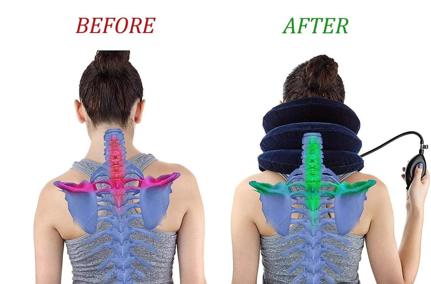 RUNZI Cervical Neck Traction Device Inflatable Stretcher, One Size, Blue