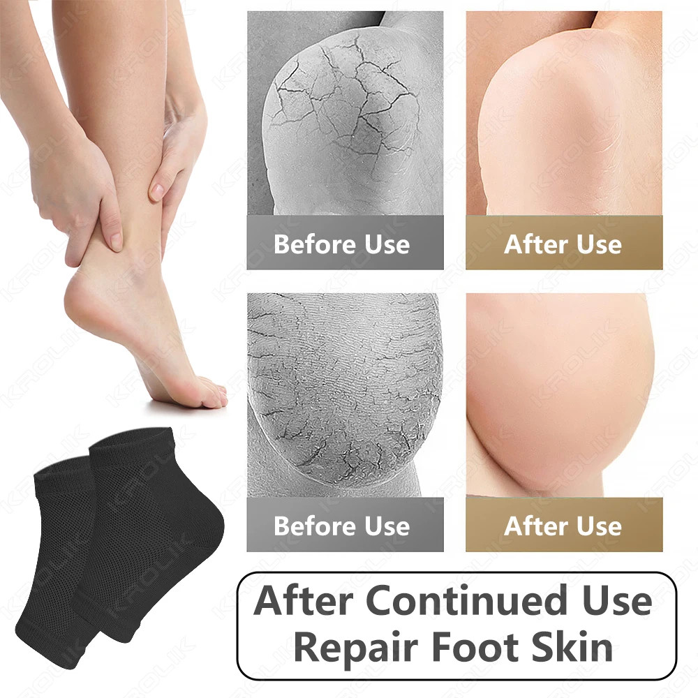 1 Pair Silicone Feet Heel Moisturizing Socks Gel Socks Cracked Foot Toele