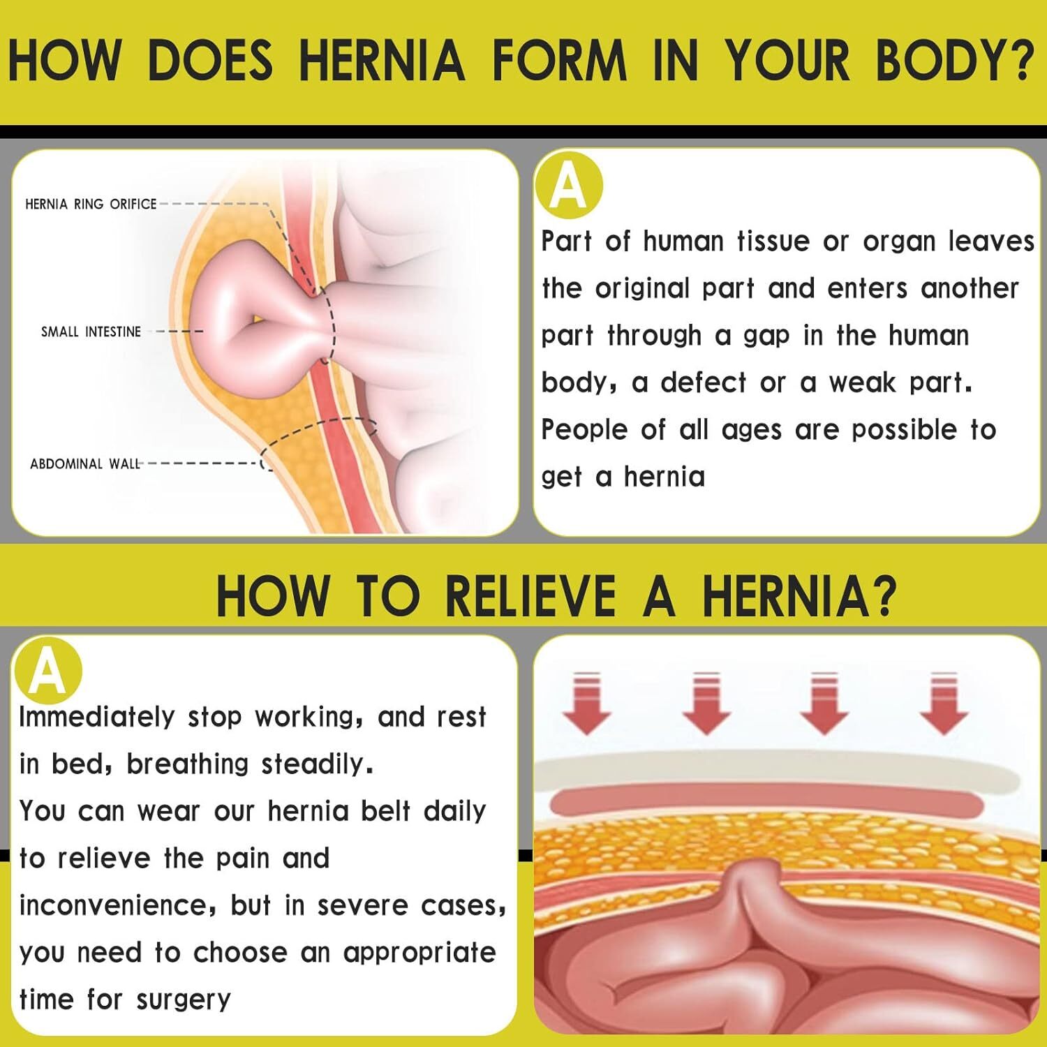 Hernia Support Belt Men Truss For Inguinal With 2 Removable Compression Pads USA